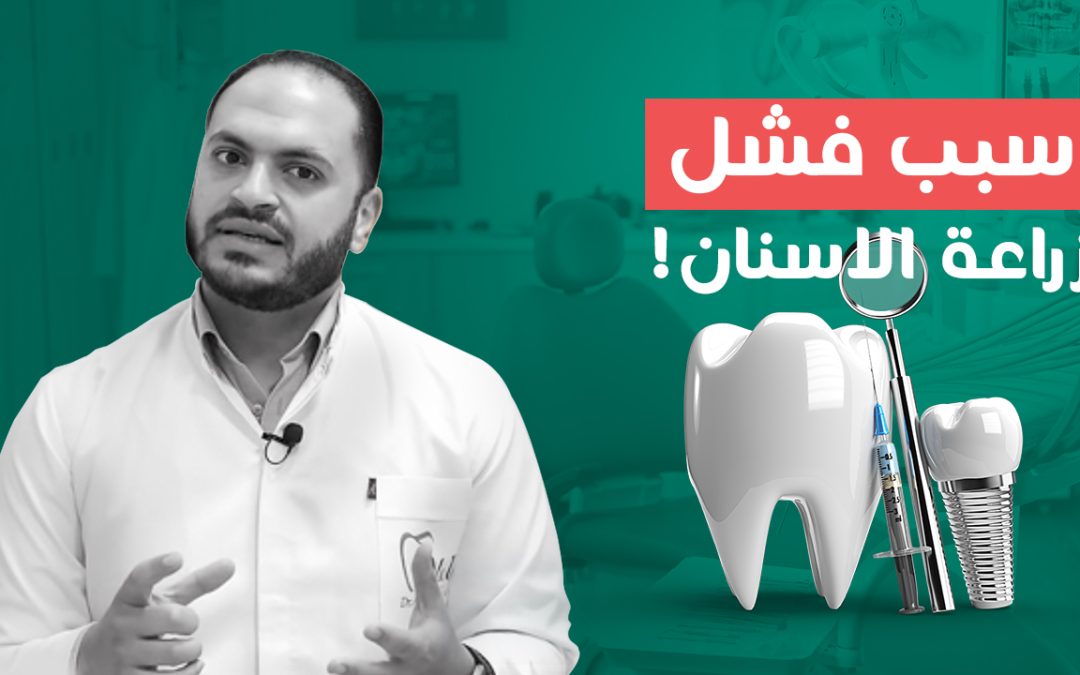 أعراض فشل زراعة الاسنان (4 أعراض وهمية وباقي الأعراض خطيرة!)