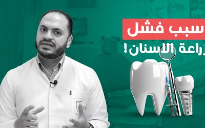 ازاي تعرف إن زراعة الأسنان فشلت ومحتاج ترجع للدكتور؟