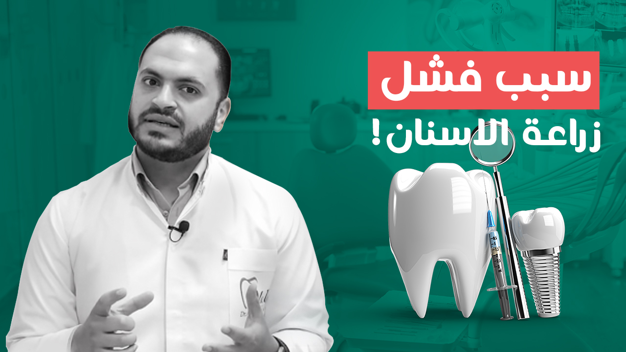 أضرار خلع الأسنان (الاسنان الطبيعية لا تقدر بثمن)