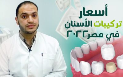 أسعار تركيبات الأسنان في مصر 2022 (مش كل الخامات زي بعض ☝ ) | د/ أحمد العايدي