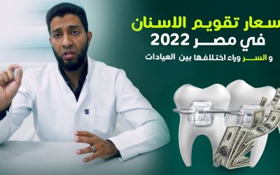 أسعار  تقويم الاسنان في مصر 2022