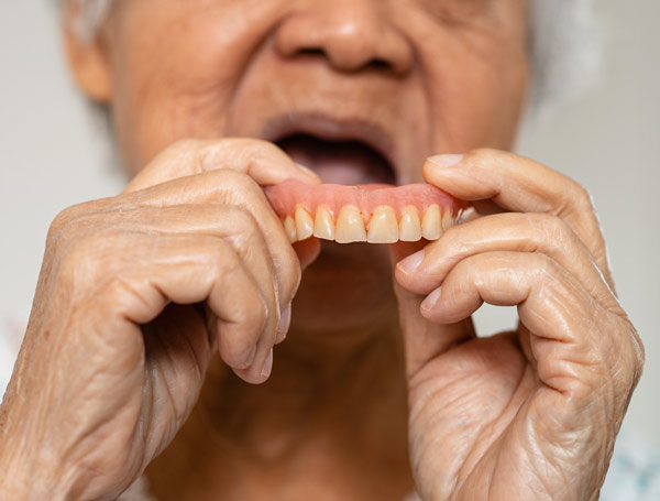 نصائح من دكتور أسنان في القاهرة للاعتناء بصحة الأسنان - توقف عن طحن الأسنان.